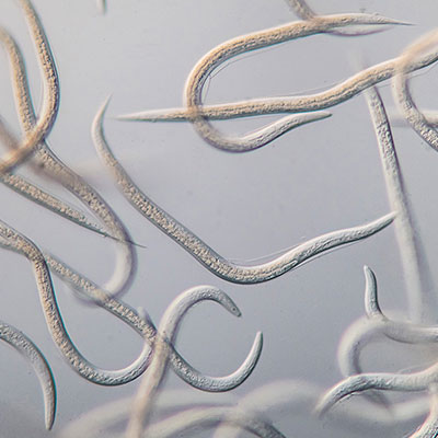 Nahaufnahme Mikroskop Nematoden